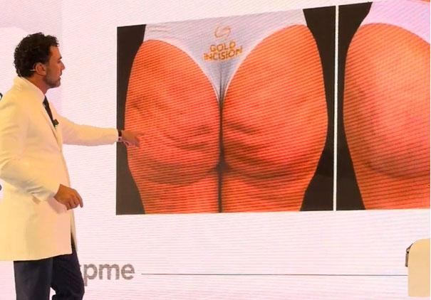 Dr Chacur é speaker GoldIncision no Congresso de Medicina de Portugal