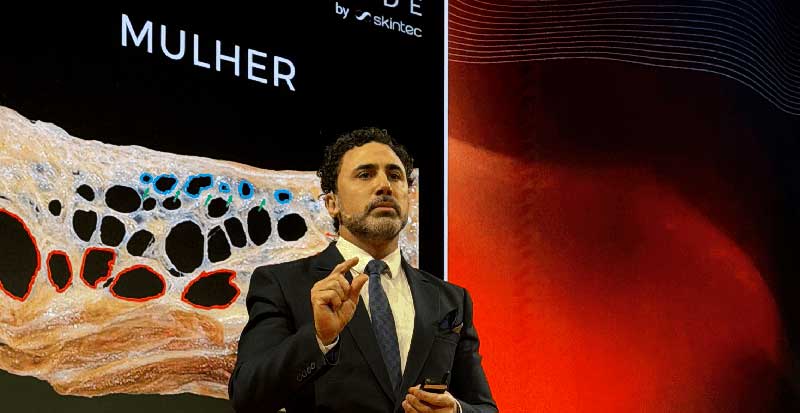 Dr Chacur palestra sobre radiofrequência microagulhada com GoldIncision